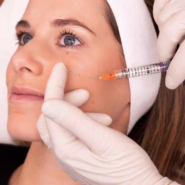 microcanula softfil precision injectare fata