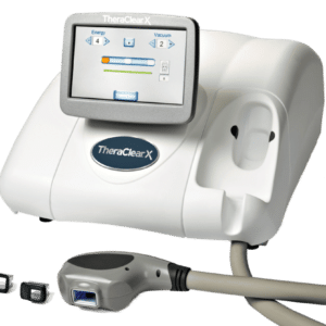 carbobes, dispozitiv de carboxiterapie